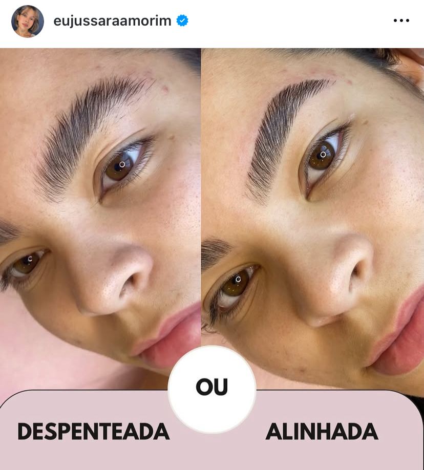 ser8